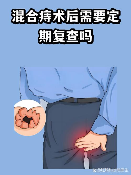 意天空:迪巴拉接受左膝关节探查手术,之后才能评估具体康复时间