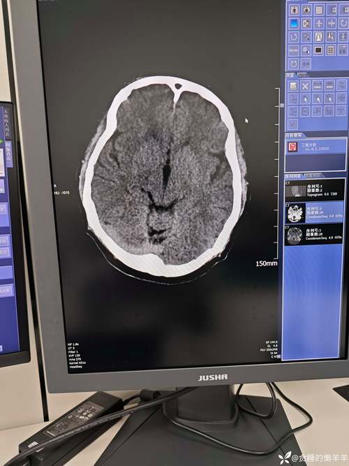 马卡：瓦伦西亚队长加亚头部连续被撞，随后视力模糊送往医院检查