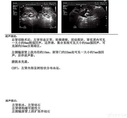 好消息！雷迪克：八村塁核磁共振检查结果无异常 目前为每日观察