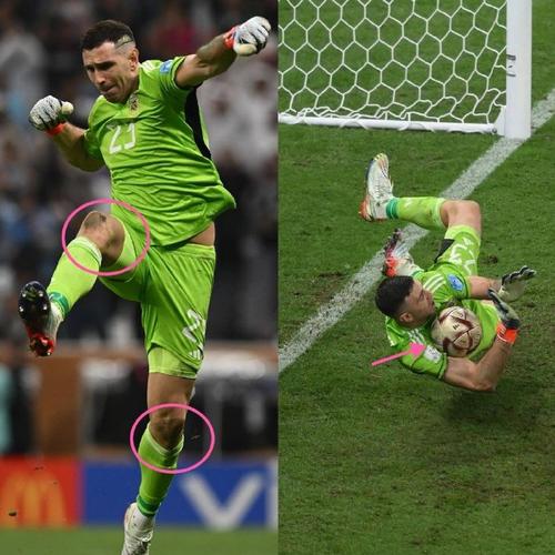 尼昂：帕托能做到姆巴佩做不到的动作，他的大腿有你两条腿那么粗