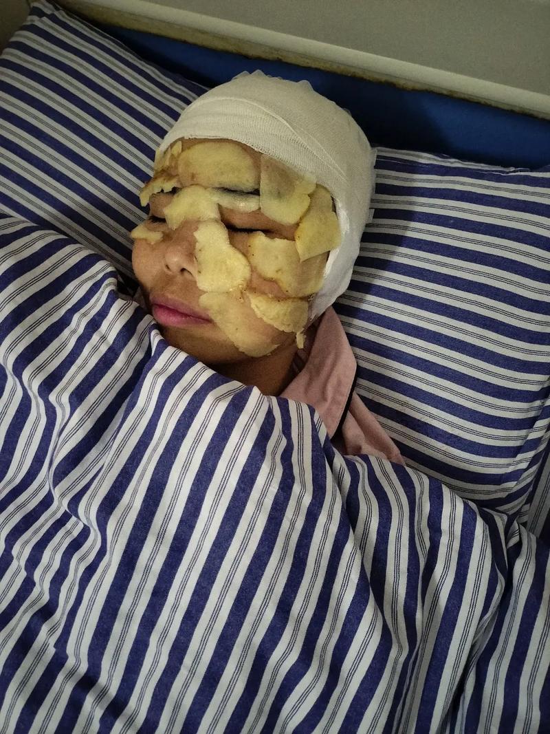 一度失忆！切赫回忆头部骨折：若再晚20分钟送医，结果就不好说了