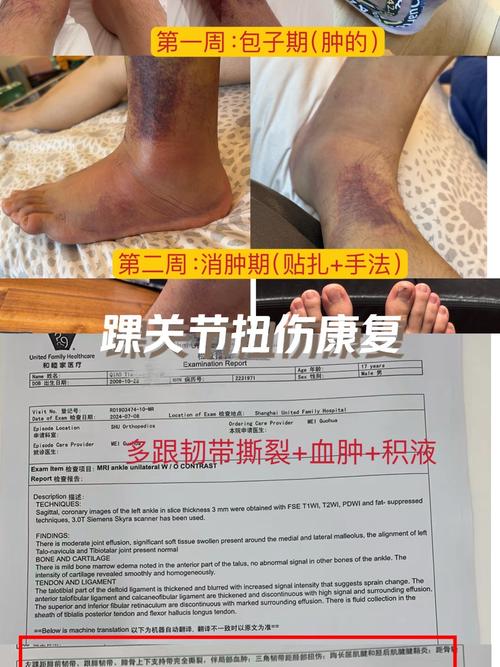 图片报:22岁法兰克福中卫科林斯脚踝韧带严重受伤,赛季报销