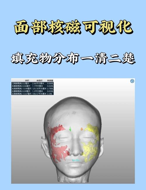 故意还是不小心？达拉斯曾给里夫斯做MRI 但扫错了部位