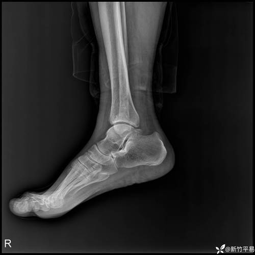 遭恶意犯规后受伤！斯波：约维奇脚踝扭伤 并没有骨折的情况