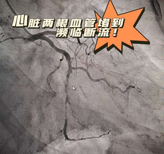 阿斯:CTA未对马丁的降格改判正式表态,但部分成员认为应是直红