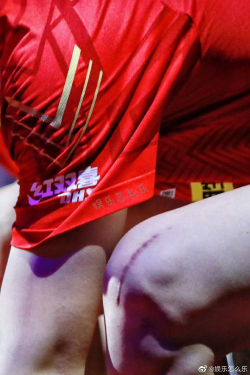 血洒球场!ESPN晒姆巴佩伤口图,伤痕明显有些肿