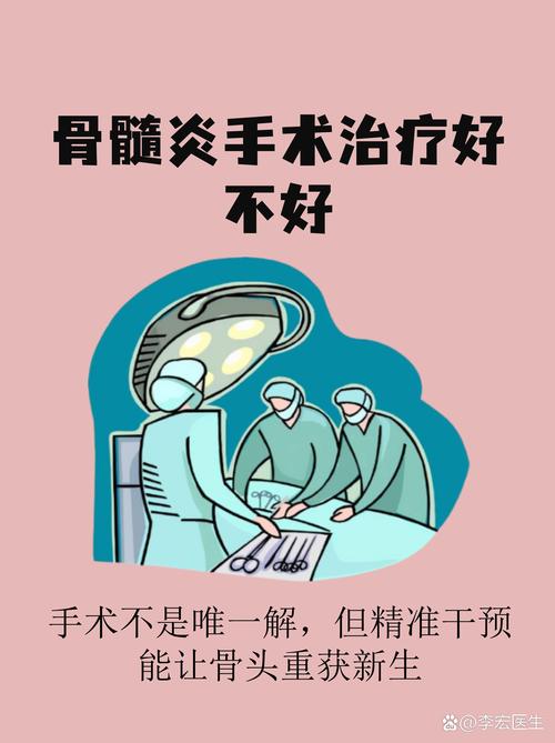 媒体人：于德豪膝关节的问题很多 拖到如今手术已是唯一治疗方案