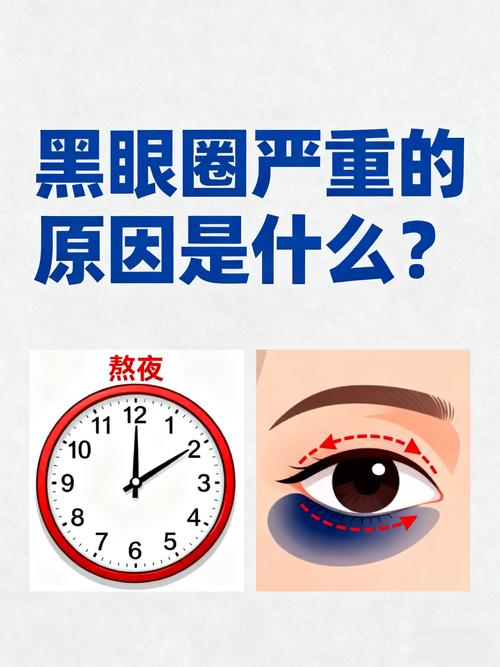 蓉城“黑眼圈”翻译:陪费利佩在医院好几天,没睡好更黑了