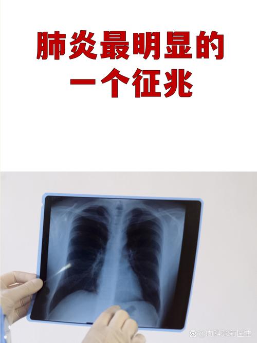 记者：贺希宁患重度病毒性感冒 带病出战了两场比赛后病情加重了